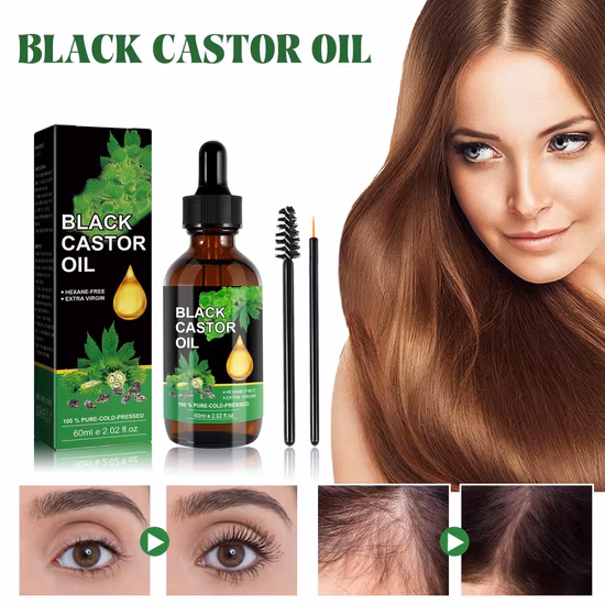 Minoxidil Hair Products for Healthy Hair Growth Products 60ml Kirkland 5% Hair Growth Oil